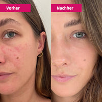 CLARIFYING MASK